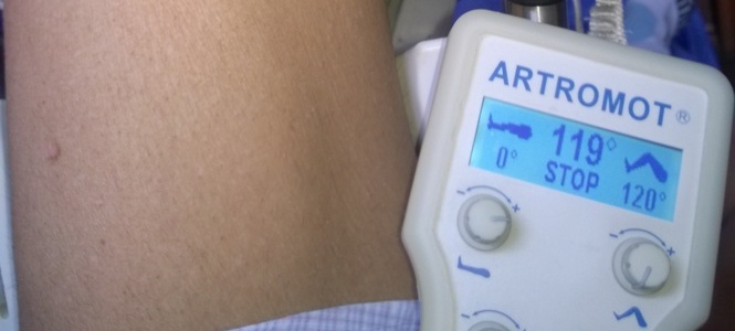 Rieducazione Del Ginocchio Dopo Operazione Di Ricostruzione LCA – La Mia Esperienza